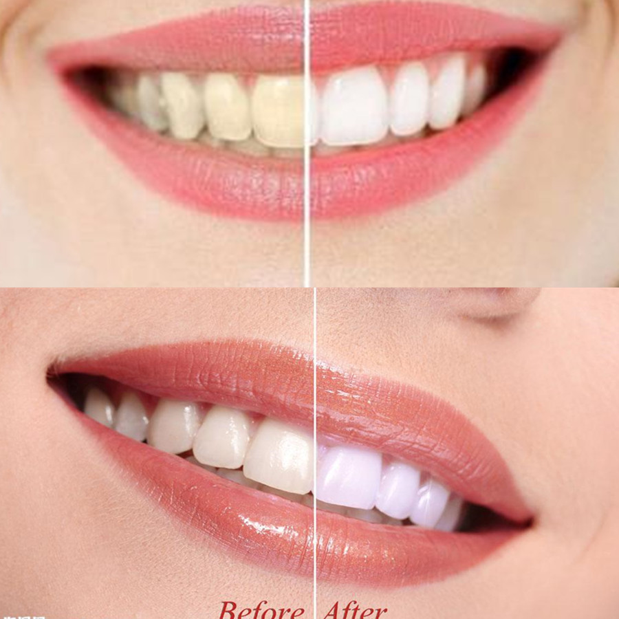 Bamboo Charcoal Teeth Tooth De - Teeth Whitening Quotes 评论和价格