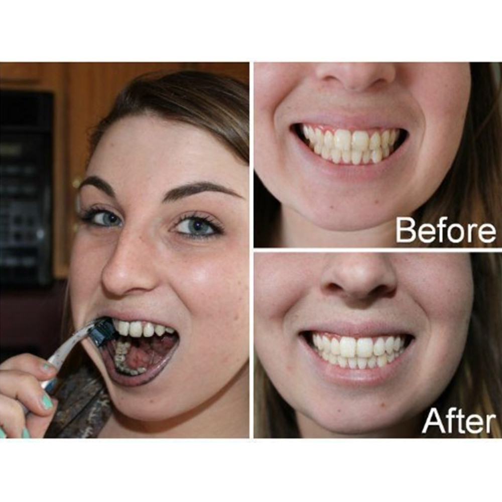 Bamboo Charcoal Teeth Tooth De - Teeth Whitening Quotes 评论和价格