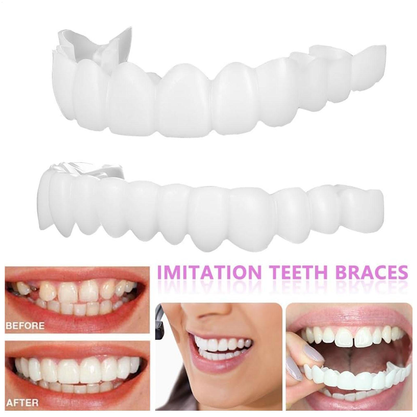 Dental Upper Lower Fake Teeth  - Teeth Whitening In Office 评论和价格