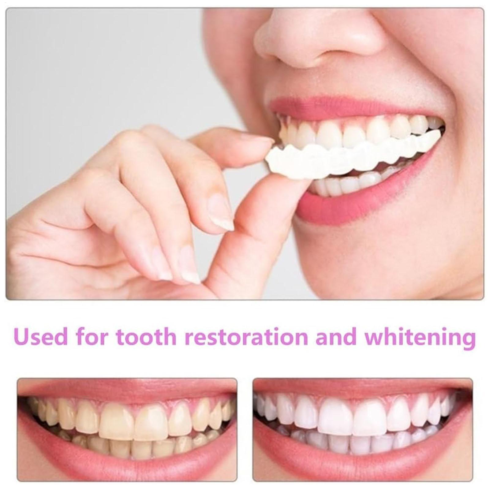 Dental Upper Lower Fake Teeth  - Teeth Whitening In Office 评论和价格