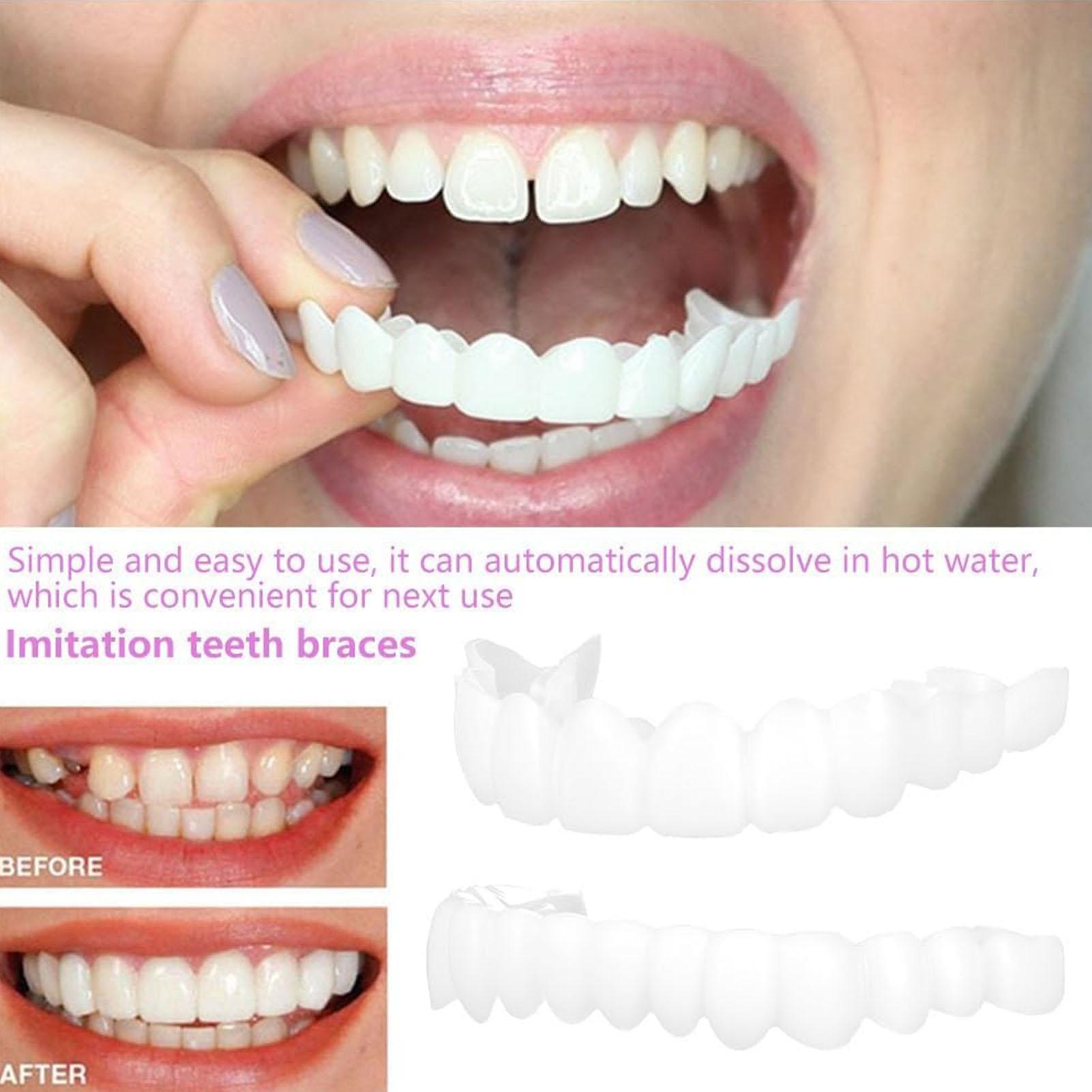 Dental Upper Lower Fake Teeth  - Teeth Whitening In Office 评论和价格