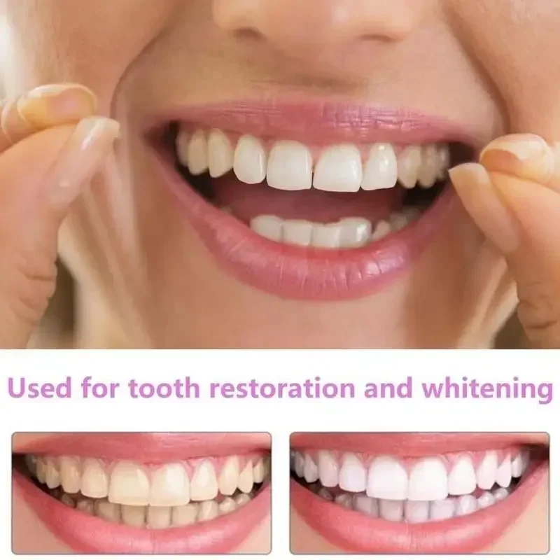 Charming Smile Teeth Veneers,  - Teeth Whitening Uneven 评论和价格