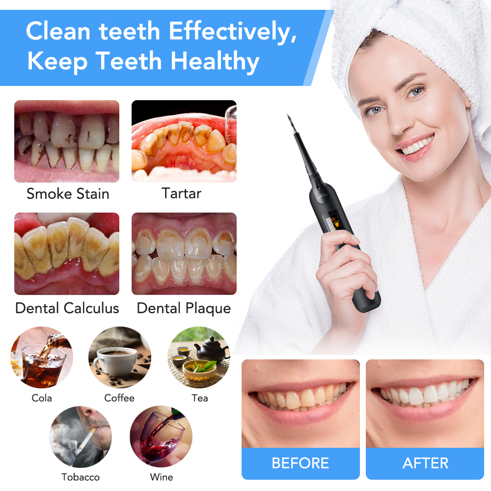 Teeth Tartar Remover Electric  - Teeth Whitening In Office 评论和价格