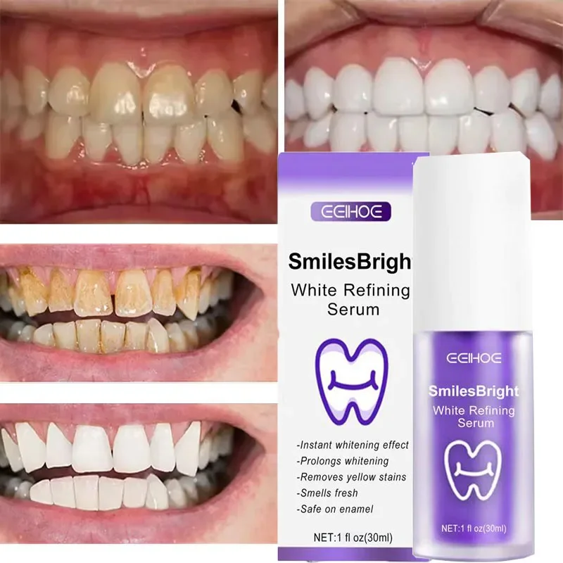 Teeth Cleansing Whitening Toot - Teeth Whitening Korea 评论和价格