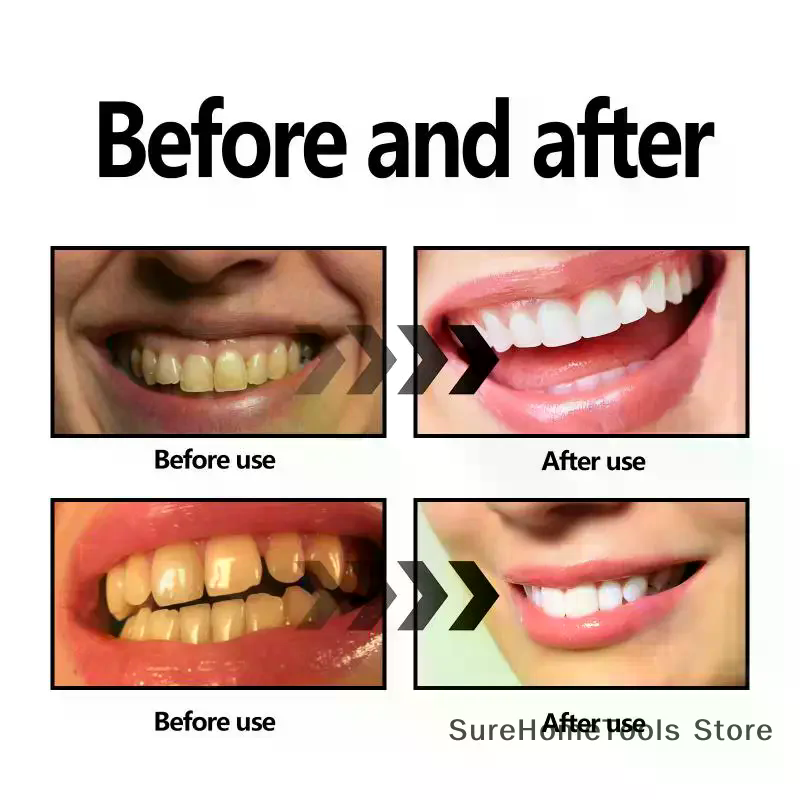 Bamboo Charcoal Powder For Tee - Teeth Whitening Quotes 评论和价格