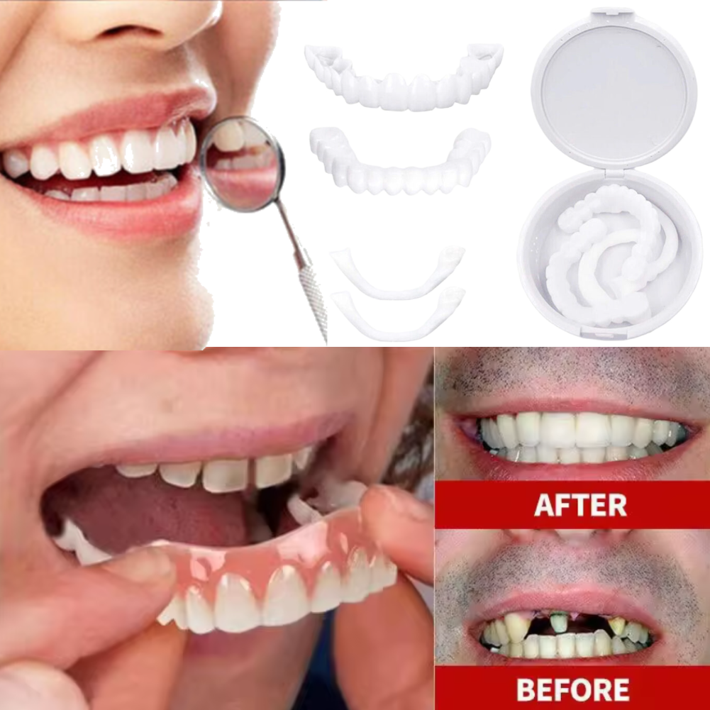 Charming Smile Teeth Veneers,  - Teeth Whitening Uneven 评论和价格