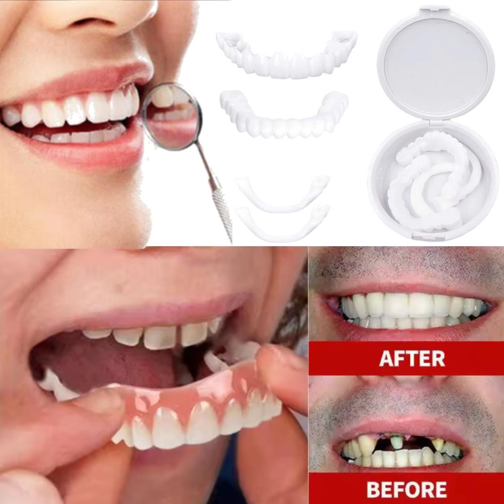 New Charming Smile Teeth Venee - Teeth Whitening Uneven 评论和价格