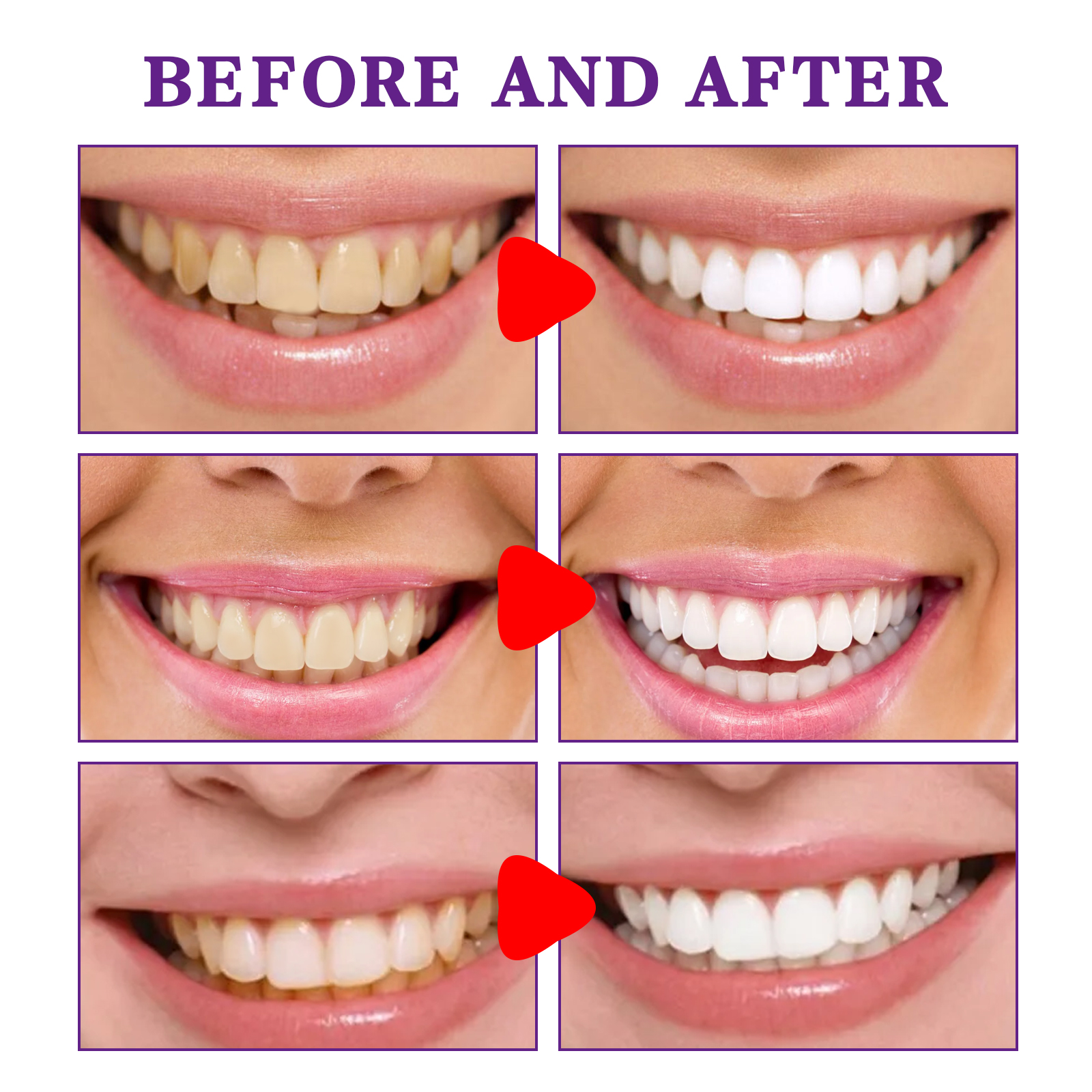 Teeth Cleansing Whitening Toot - Teeth Whitening Korea 评论和价格