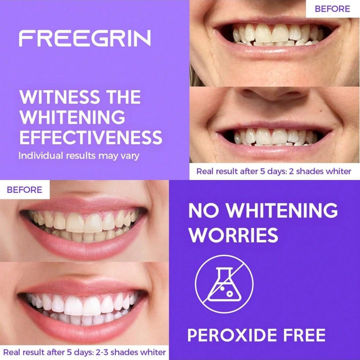 Deluxe Whitening Teeth Sticker - Teeth Whitening Quotes 评论和价格