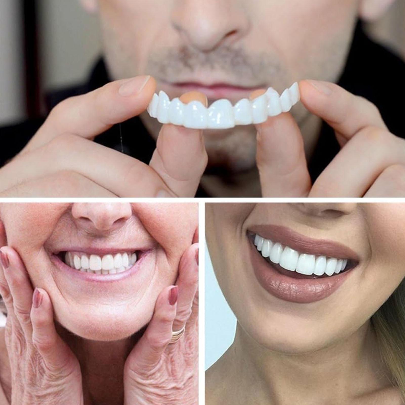 New Defect Repair Teeth Veneer - Teeth Whitening Uneven 评论和价格