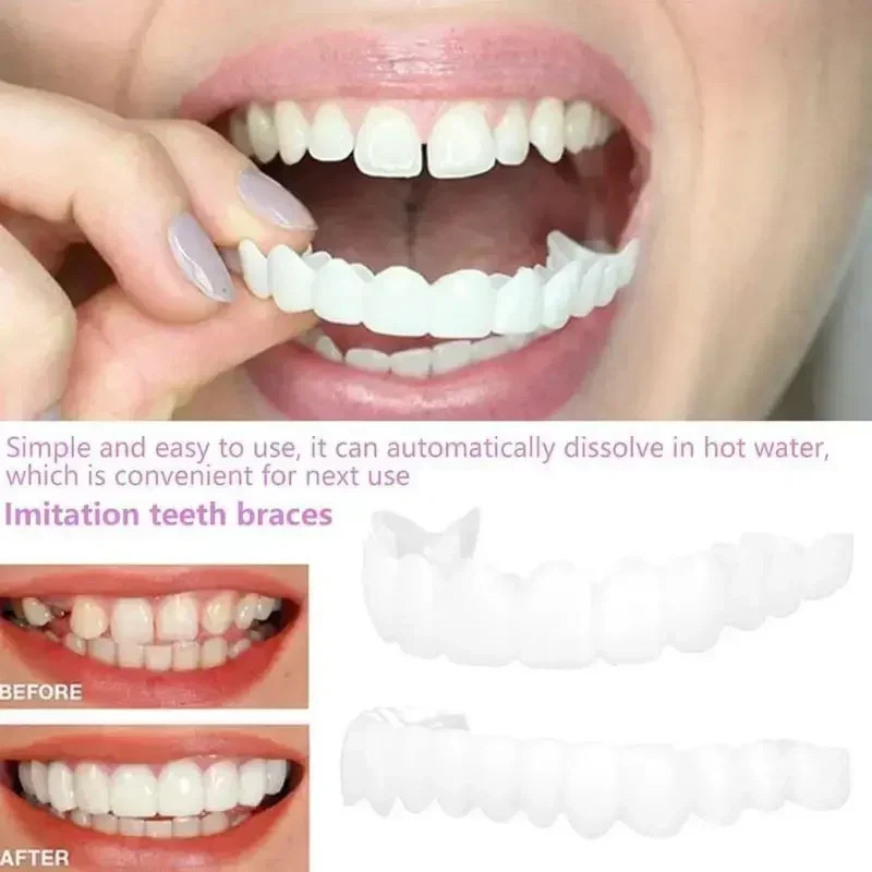 Charming Smile Teeth Veneers,  - Teeth Whitening Uneven 评论和价格