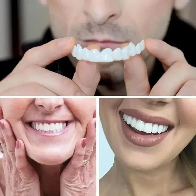 Charming Smile Teeth Veneers,  - Teeth Whitening Uneven 评论和价格