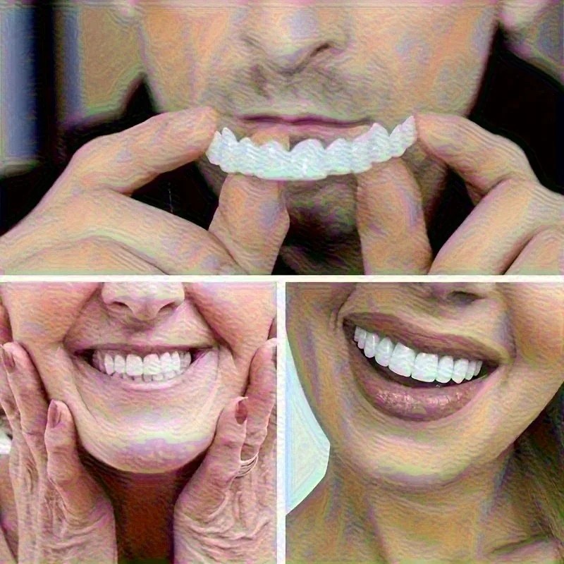 New Uneven Teeth Fix Veneers R - Teeth Whitening Uneven 评论和价格