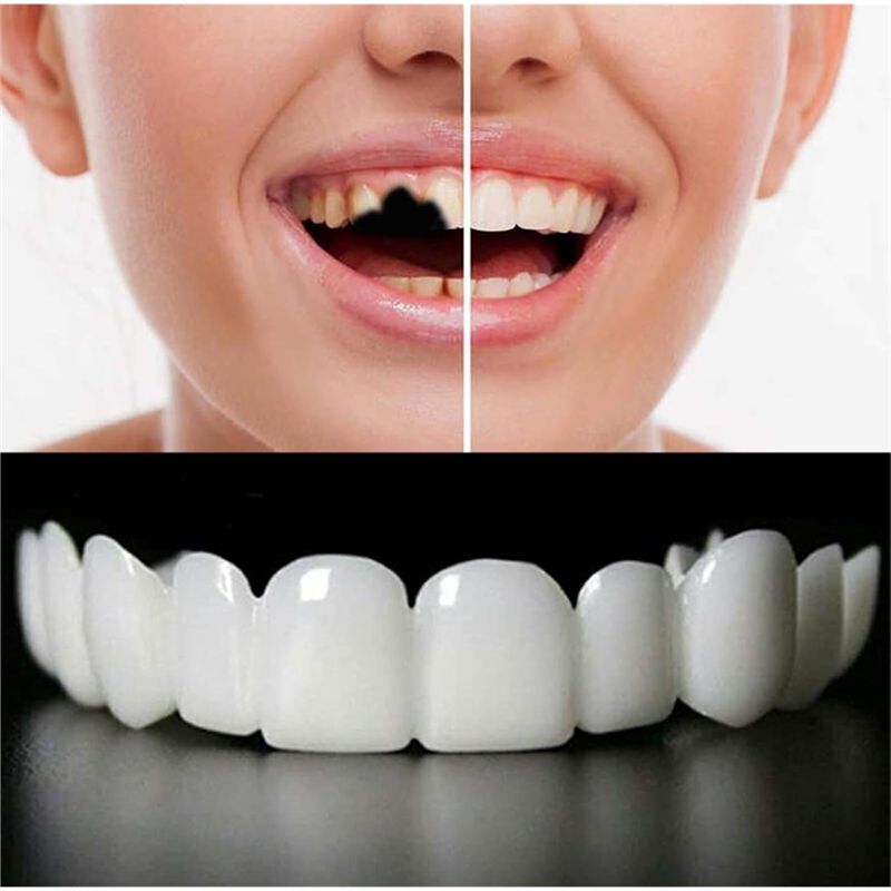 New Reusable Temporary False T - Teeth Whitening Uneven 评论和价格