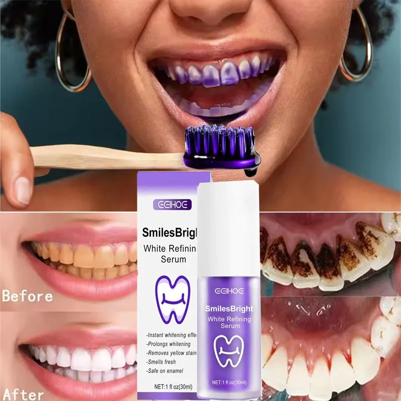 Whitening Toothpaste Teeth Cle - Teeth Whitening Korea 评论和价格