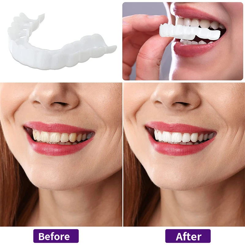 Defect Repair Teeth Veneers, T - Teeth Whitening Uneven 评论和价格