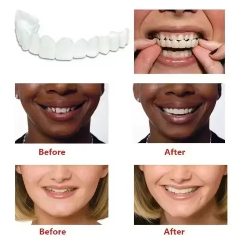 New Reusable Temporary False T - Teeth Whitening Uneven 评论和价格