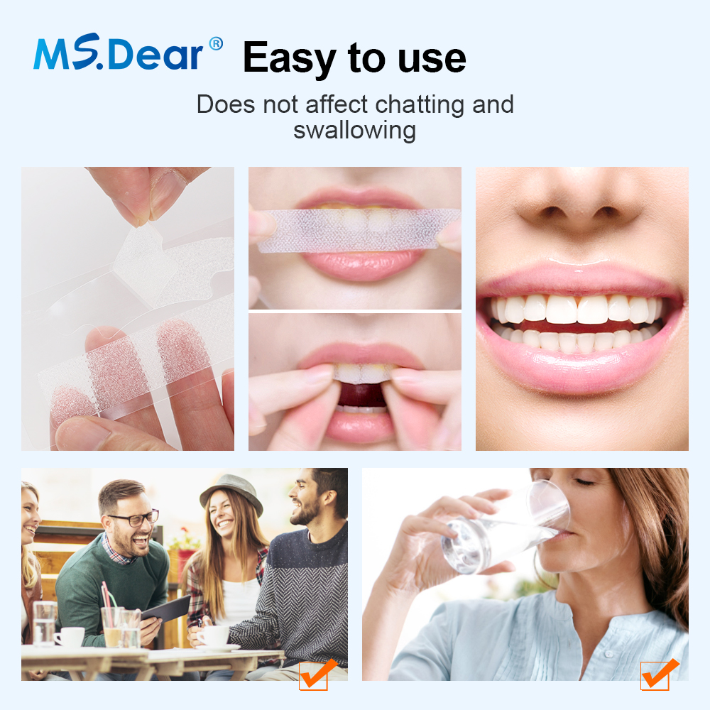 Teeth Whitening Strips Cleansi - Teeth Whitening Quotes 评论和价格